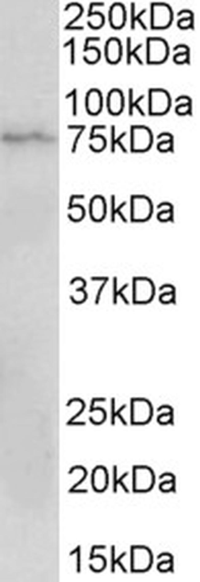 CD19 Antibody in Western Blot (WB)