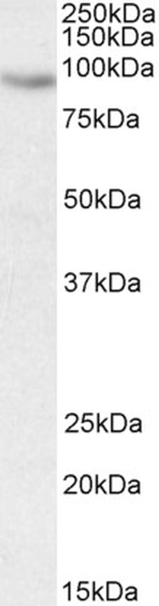 CIZ1 Antibody in Western Blot (WB)