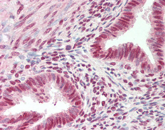 ARS2 Antibody in Immunohistochemistry (Paraffin) (IHC (P))