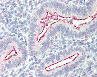 p130Cas Antibody in Immunohistochemistry (Paraffin) (IHC (P))