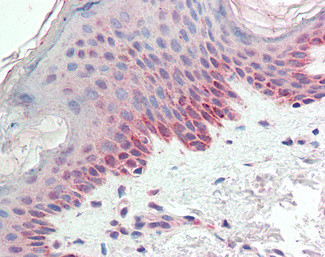 LZIP Antibody in Immunohistochemistry (Paraffin) (IHC (P))
