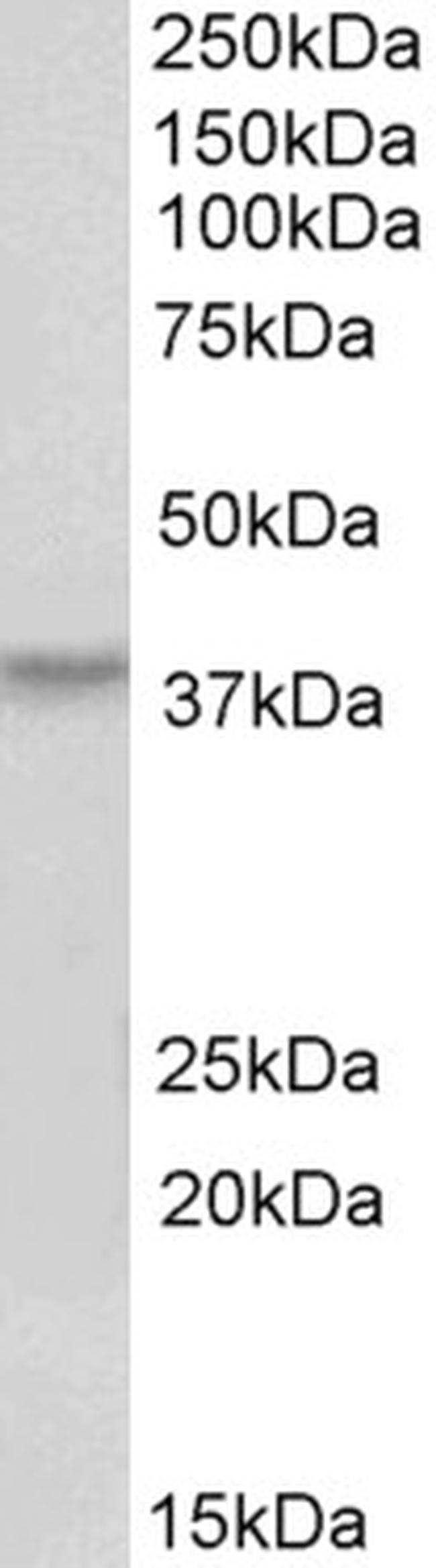 HOXA10 Antibody in Western Blot (WB)