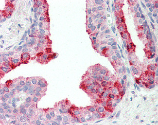 CUTA Antibody in Immunohistochemistry (Paraffin) (IHC (P))