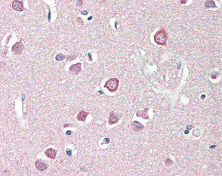 ENPP2 Antibody in Immunohistochemistry (Paraffin) (IHC (P))