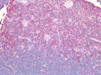 CD44 Antibody in Immunohistochemistry (Paraffin) (IHC (P))