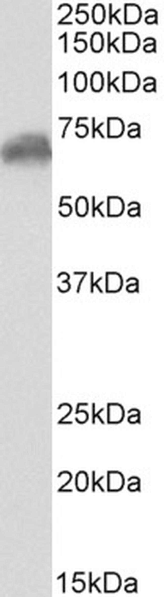 Chromogranin C Antibody in Western Blot (WB)