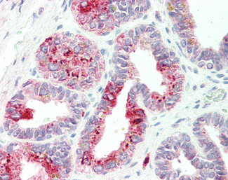 NAT1 Antibody in Immunohistochemistry (Paraffin) (IHC (P))