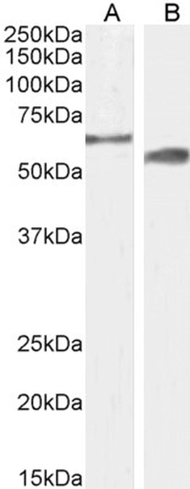 CYP2R1 Antibody in Western Blot (WB)