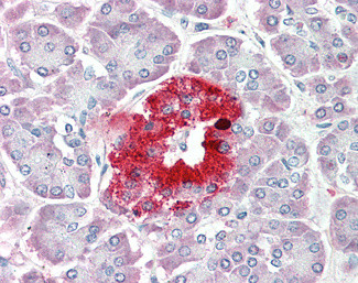 PCSK1N Antibody in Immunohistochemistry (Paraffin) (IHC (P))