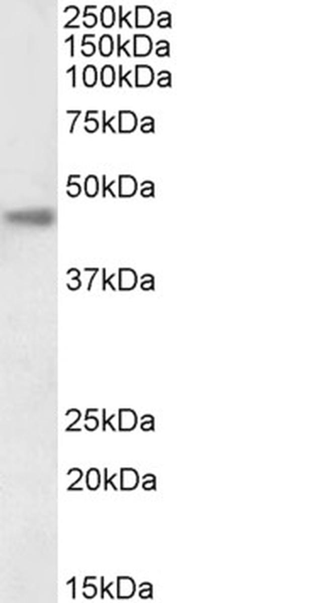 Carbonic Anhydrase XII Antibody in Western Blot (WB)