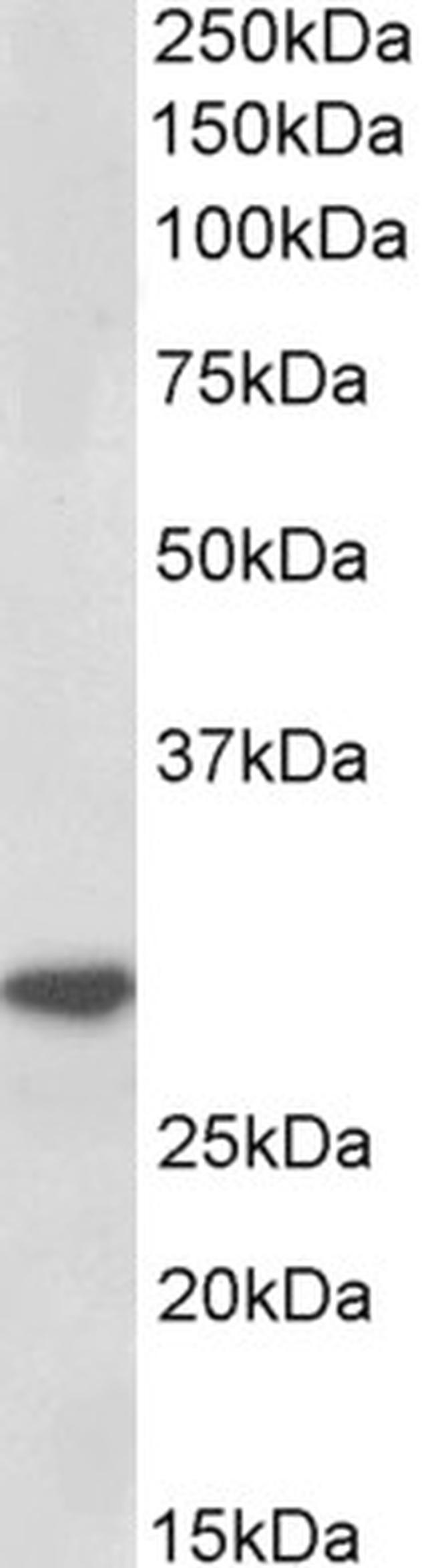 IL-1 beta Antibody in Western Blot (WB)