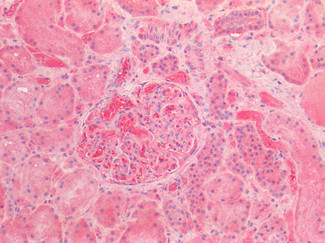 AFP Antibody in Immunohistochemistry (Paraffin) (IHC (P))