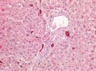 Cytokeratin 19 Antibody in Immunohistochemistry (Paraffin) (IHC (P))