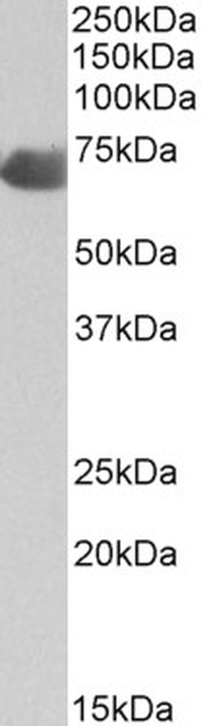 Complement C9 Antibody in Western Blot (WB)