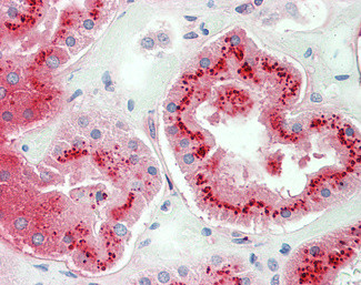 SERPINA3 Antibody in Immunohistochemistry (Paraffin) (IHC (P))