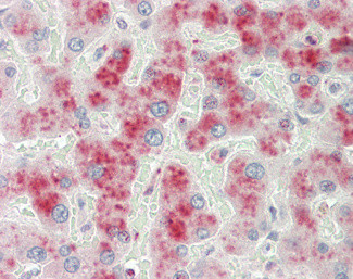 A2M Antibody in Immunohistochemistry (Paraffin) (IHC (P))