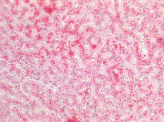 Fibrinogen alpha chain Antibody in Immunohistochemistry (Paraffin) (IHC (P))