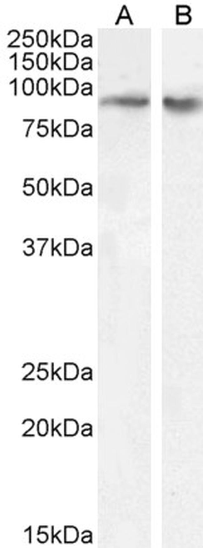 FBXO11 Antibody in Western Blot (WB)