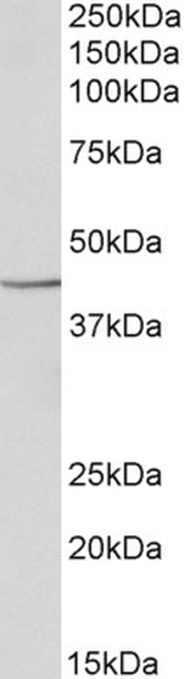 PGK1 Antibody in Western Blot (WB)