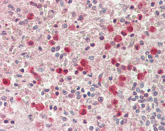 SERPINB1 Antibody in Immunohistochemistry (Paraffin) (IHC (P))