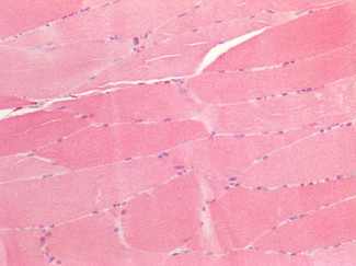 PRDX6 Antibody in Immunohistochemistry (Paraffin) (IHC (P))