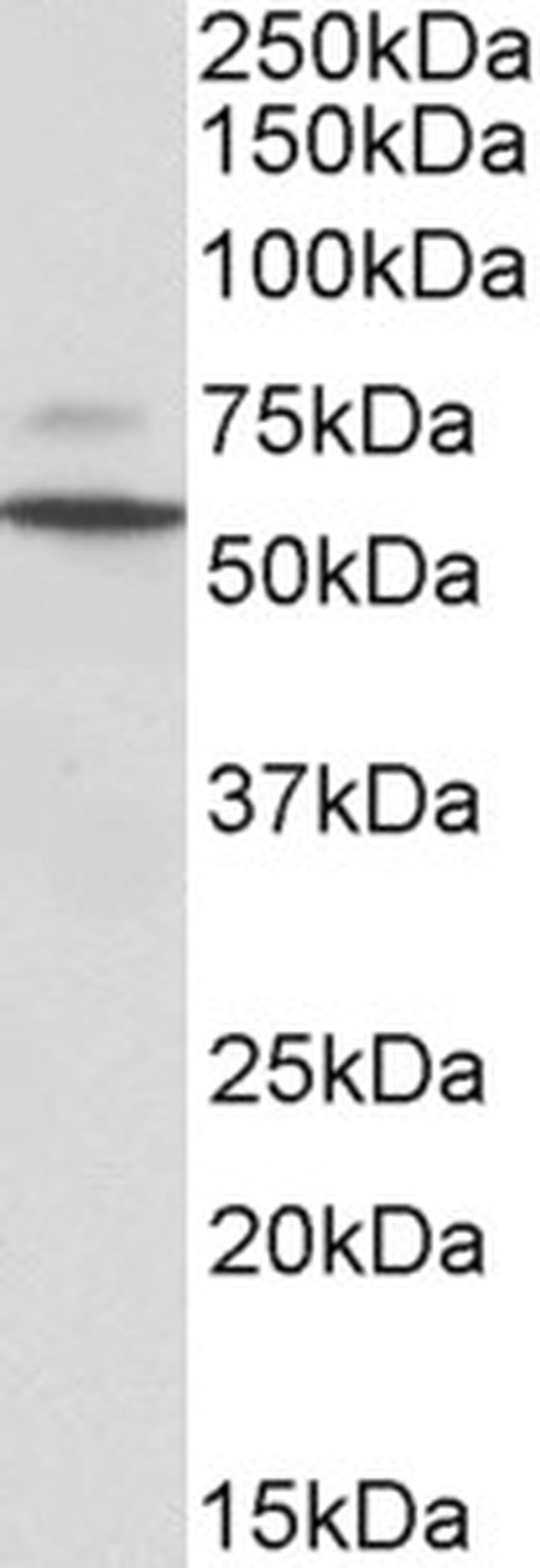 Peripherin Antibody in Western Blot (WB)