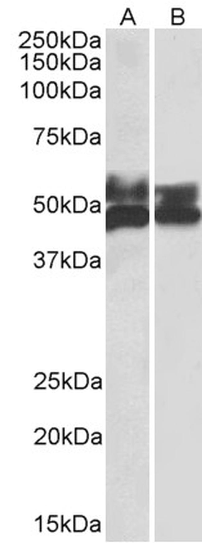 FCRL1 Antibody in Western Blot (WB)