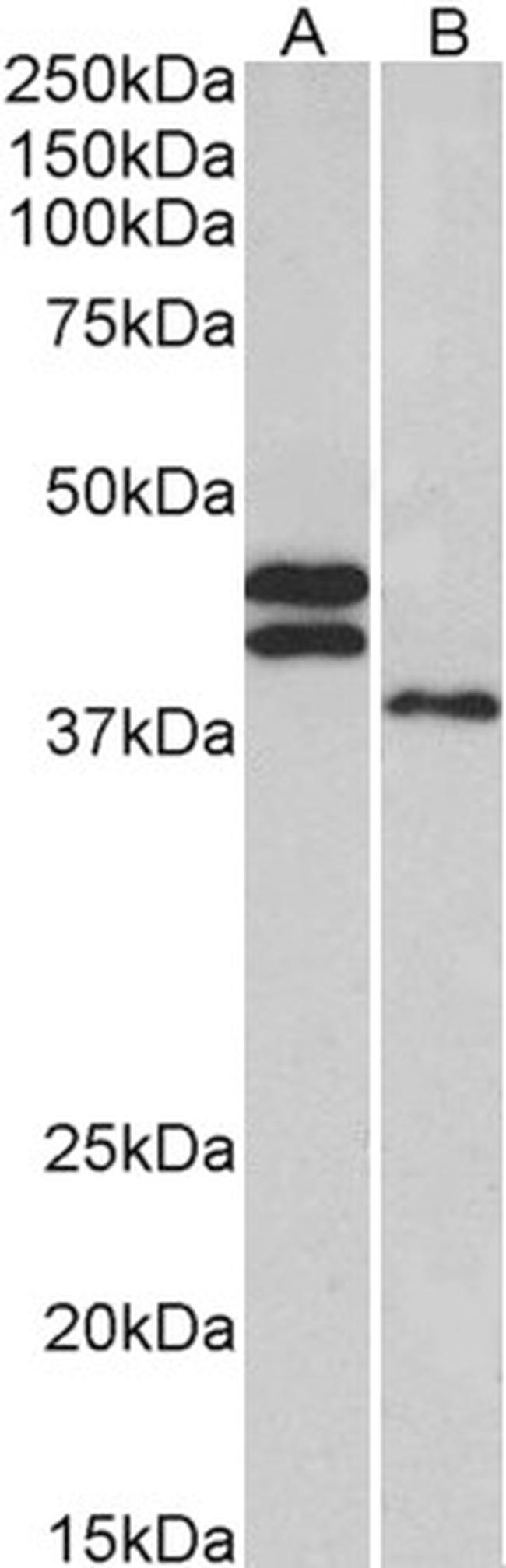 FCRL1 Antibody in Western Blot (WB)