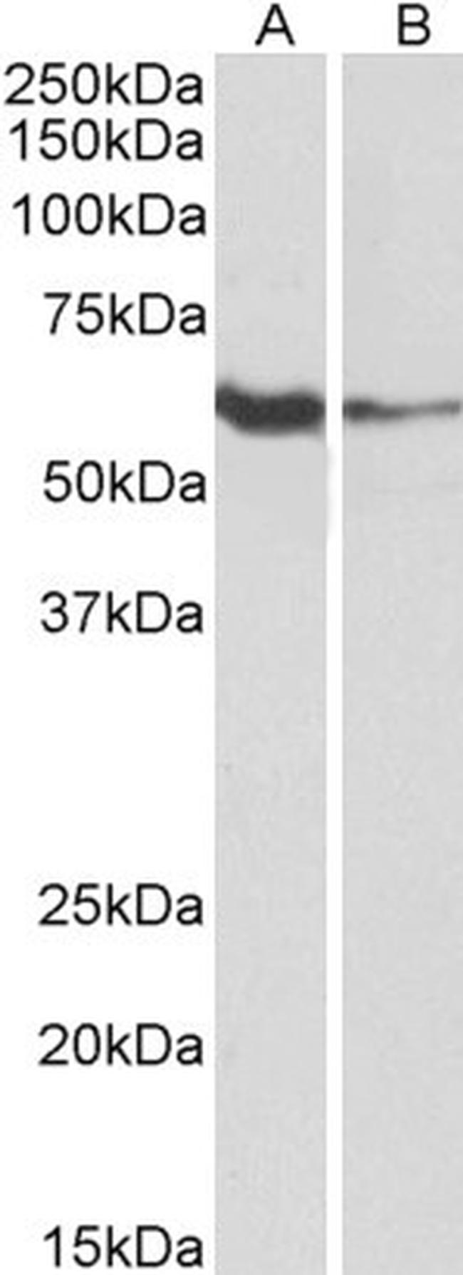 FCRL2 Antibody in Western Blot (WB)
