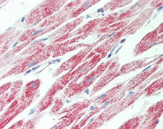 ATP Synthase gamma Antibody in Immunohistochemistry (Paraffin) (IHC (P))