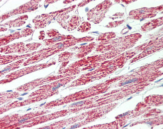 ATP Synthase B1 Antibody in Immunohistochemistry (Paraffin) (IHC (P))