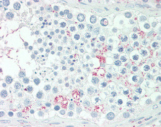 ADIG Antibody in Immunohistochemistry (Paraffin) (IHC (P))