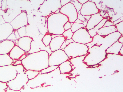 PLIN4 Antibody in Immunohistochemistry (Paraffin) (IHC (P))