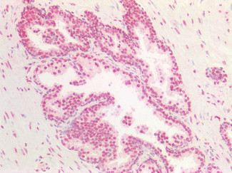 BMI-1 Antibody in Immunohistochemistry (Paraffin) (IHC (P))