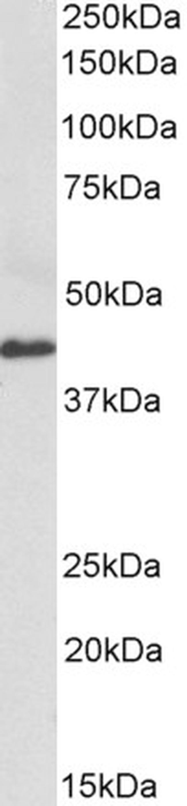 CX3CL1 Antibody in Western Blot (WB)