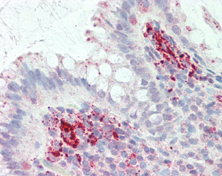CD123 Antibody in Immunohistochemistry (Paraffin) (IHC (P))