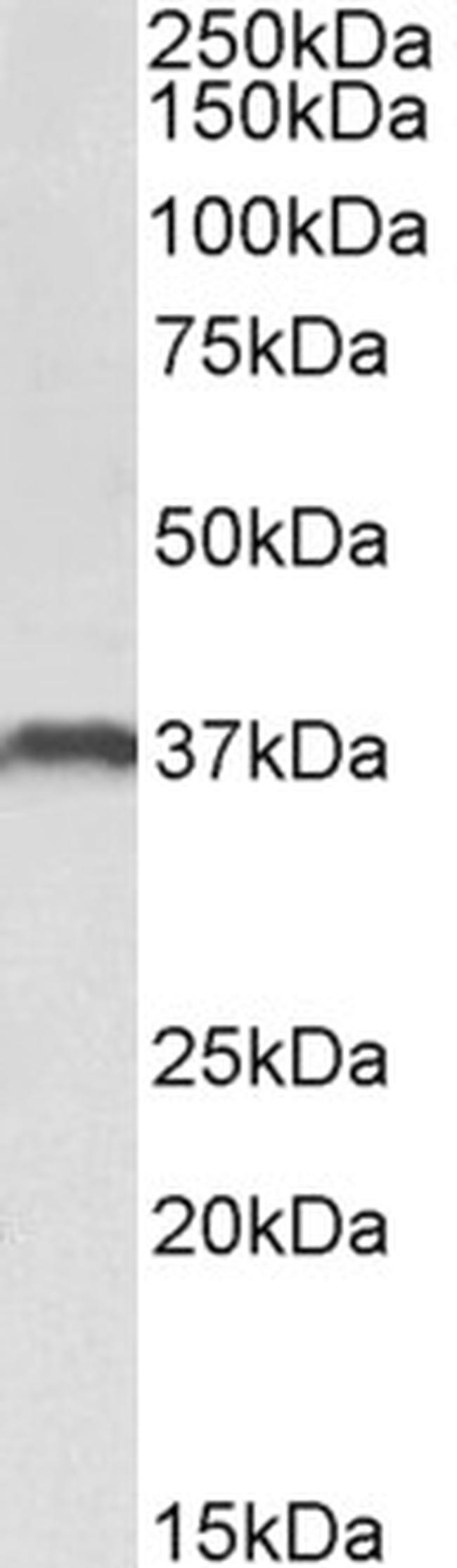 CLEC12A Antibody in Western Blot (WB)
