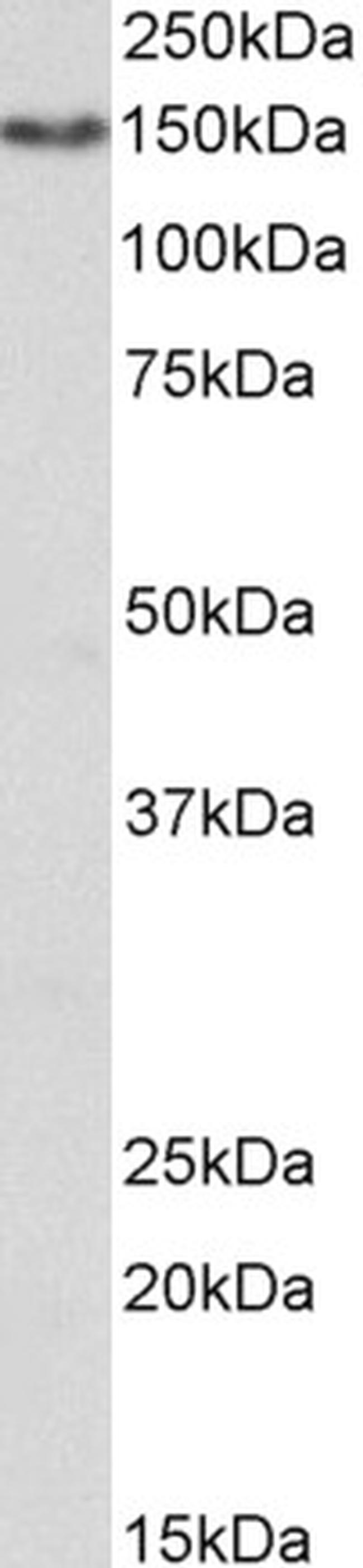 CD13 Antibody in Western Blot (WB)