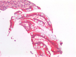 AMACR Antibody in Immunohistochemistry (Paraffin) (IHC (P))