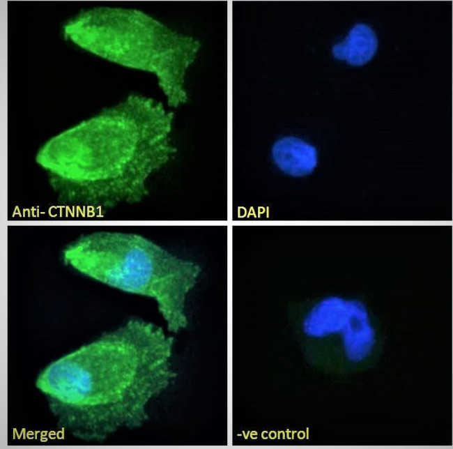 beta Catenin Antibody in Immunocytochemistry (ICC/IF)