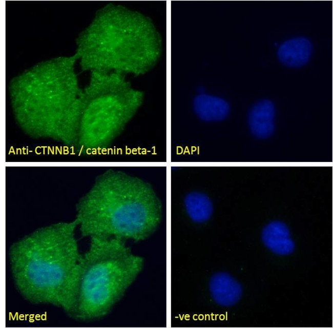 beta Catenin Antibody in Immunocytochemistry (ICC/IF)