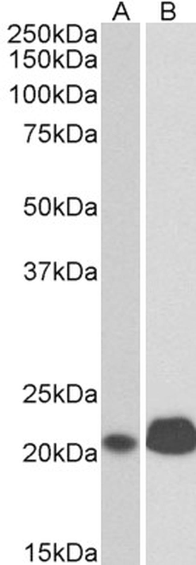 CD3E Antibody in Western Blot (WB)