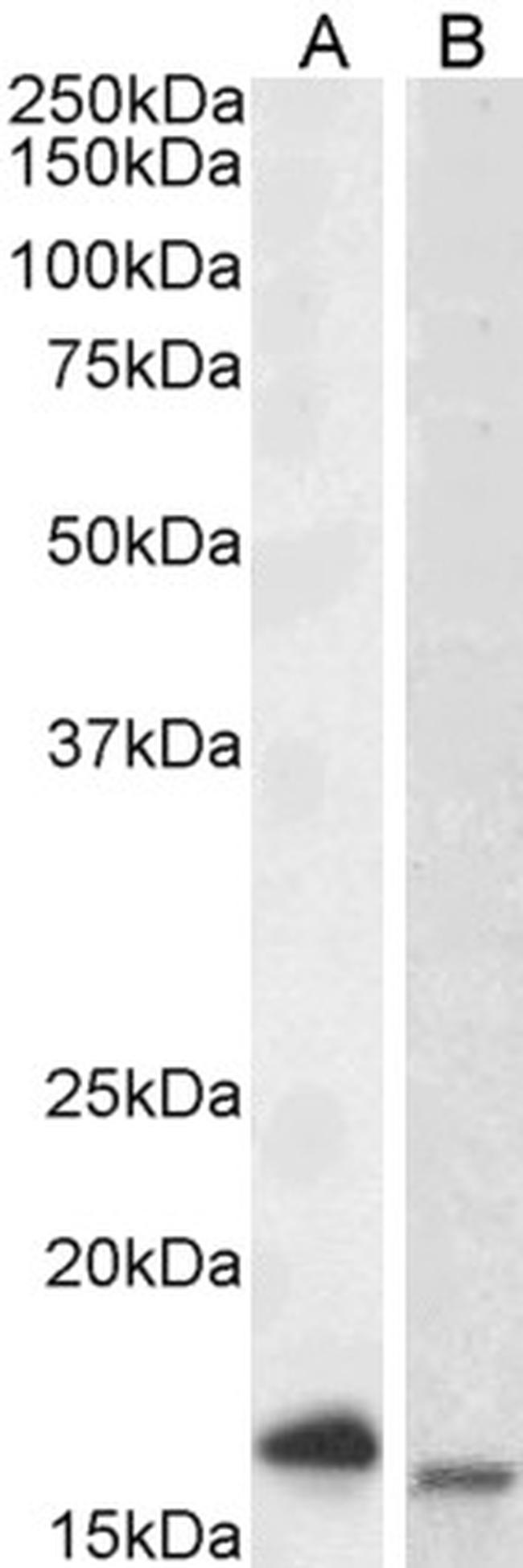 CD3 zeta (CD247) Antibody in Western Blot (WB)