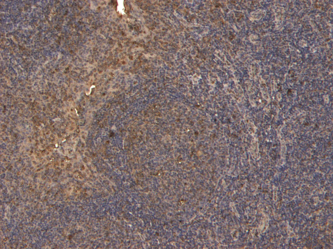 CD4 Antibody in Immunohistochemistry (Paraffin) (IHC (P))