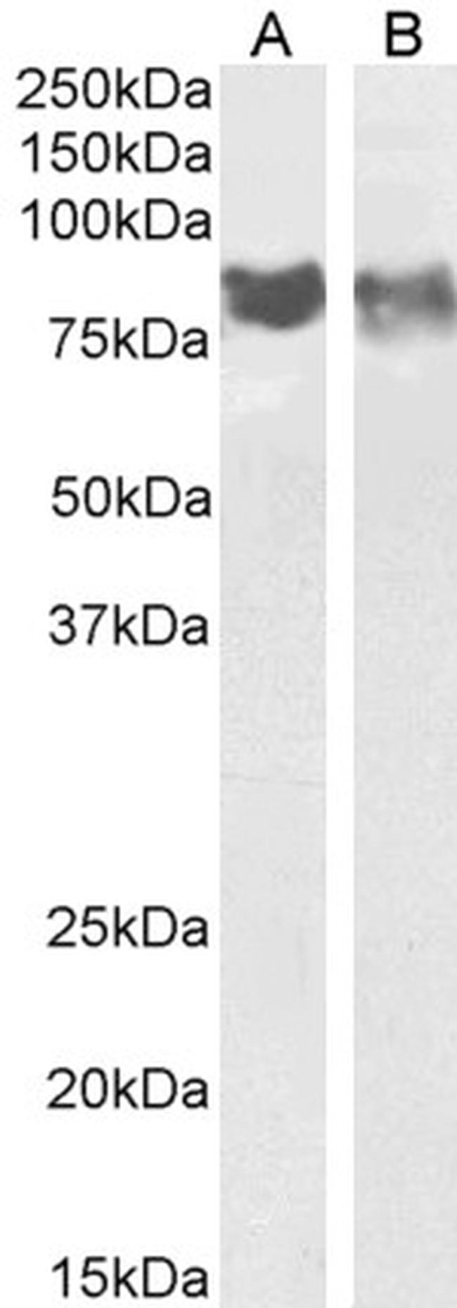 CD31 (PECAM-1) Antibody in Western Blot (WB)