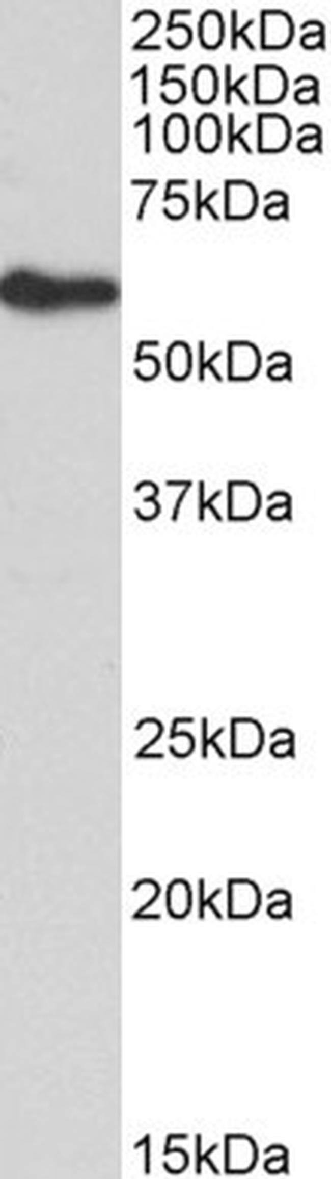 FRS2 Antibody in Western Blot (WB)