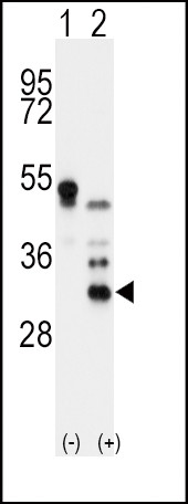 Apolipoprotein D Antibody in Western Blot (WB)