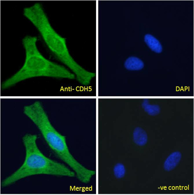 VE-cadherin Antibody in Immunocytochemistry (ICC/IF)