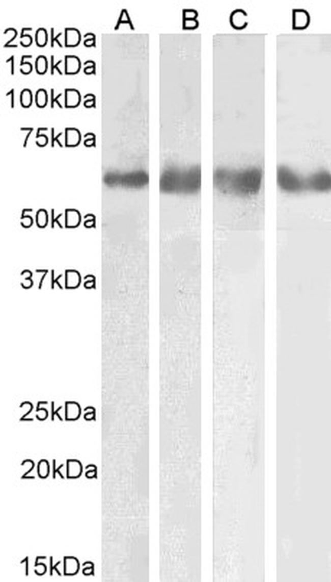GABRG2 Antibody in Western Blot (WB)