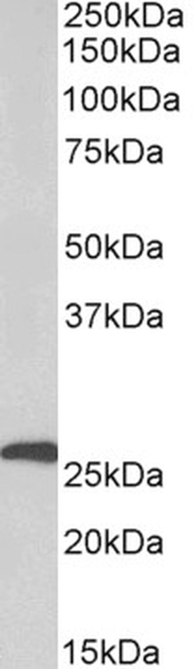 Factor D Antibody in Western Blot (WB)